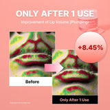 NIDA Ultimate Lip Care Set (Lip Serum + Lip Mask)