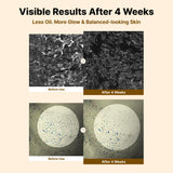 NIDA White Rice Whitehead Exfoliating Serum