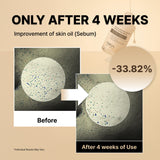 NIDA White Black Exfoliating Serum Duo Bundle